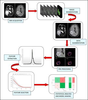 Predicting IDH subtype of grade 4 astrocytoma and glioblastoma from tumor radiomic patterns extracted from multiparametric magnetic resonance images using a machine learning approach